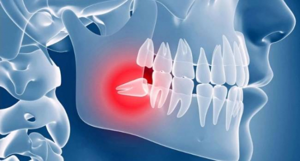7 причин, вызывающих зубную боль