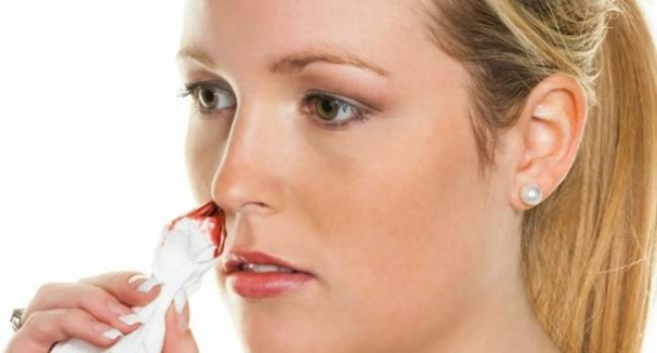 Что вызывает кровотечение из носа, как его предотвратить