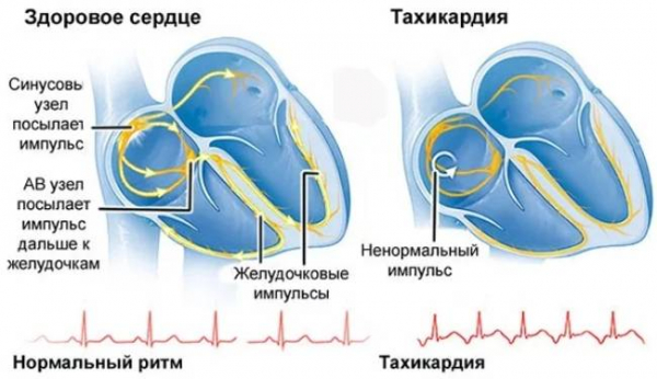 8 признаков проблем с сердцем, о которых вы должны знать