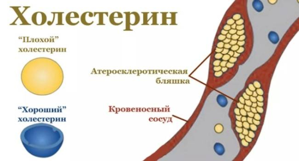 6 симптомов гипотиреоза у пожилых людей