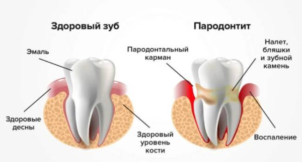 Правда о потере зубов